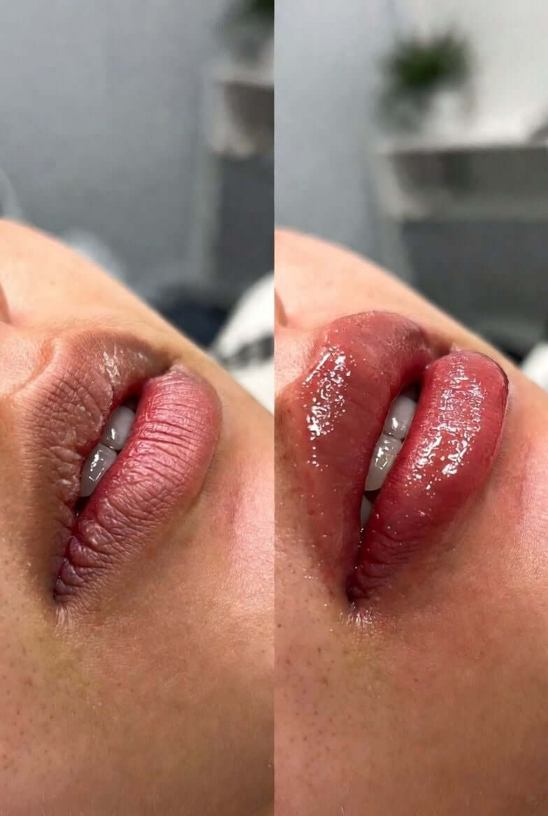 Before and after using Lip Care Deluxe Bundle, showcasing hydrated and smooth lips in two different views.