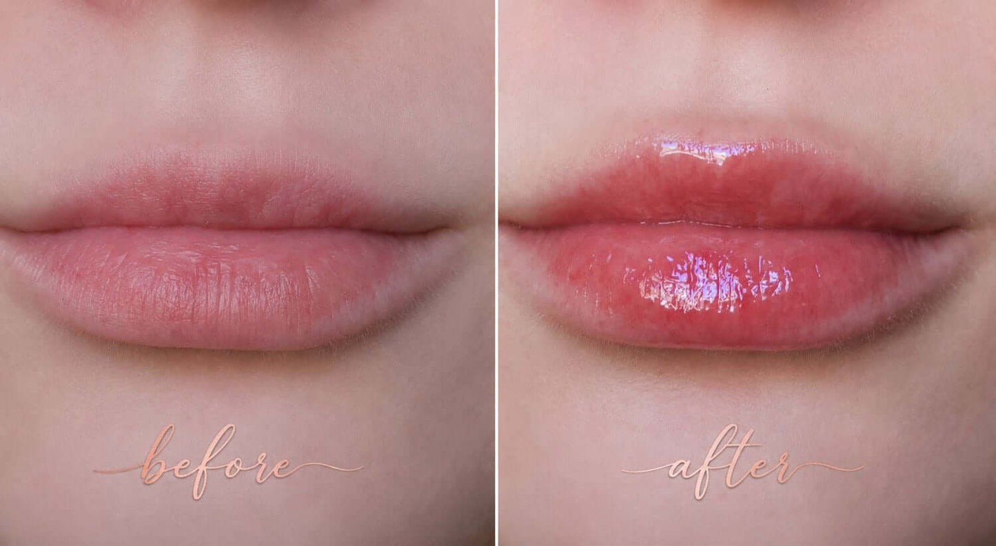 Before and after image showing lips with Strawberry Bomb S-Bomb Elevate Bundle skincare results.